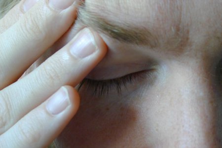 Мигрень Мигрень